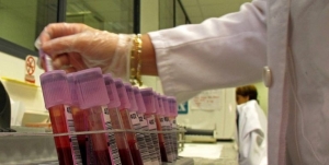 Científicos transforman sangre tipo A en O universal